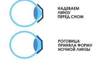 Все, что нужно знать о ночных линзах для здоровья глаз