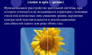 Патология зрения – рефракционная амблиопия и её лечение
