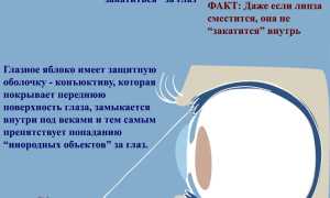 4 эффективных метода, достать линзу, если она закатилась за глаз, в домашних условиях