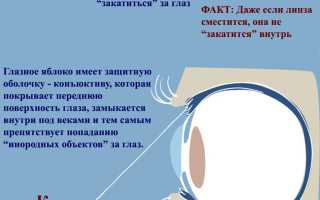 4 эффективных метода, достать линзу, если она закатилась за глаз, в домашних условиях