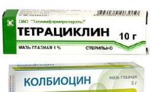 Эффективные мази для глаз от воспаления и покраснения: советы и рекомендации