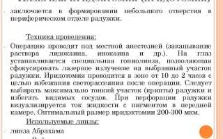 Лазерная иридэктомия: показания и суть операции для пациентов