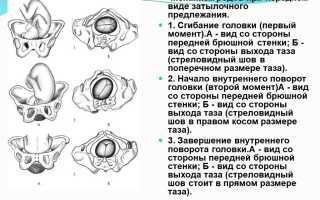 Особенности родов при затылочном предлежании: важные аспекты и рекомендации