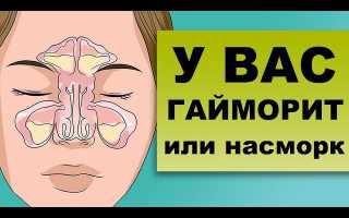 Гнойный гайморит: симптомы и лечение, эффективные рецепты, видео-советы
