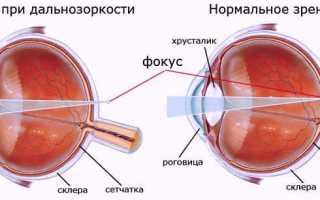 Может ли зрение улучшиться – можно ли с помощью упражнений для глаз?