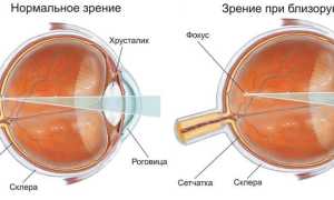 Зарядка для глаз для улучшения зрения – популярные упражнения для здоровья
