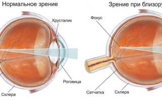 Зарядка для глаз для улучшения зрения – популярные упражнения для здоровья