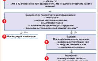Синусовая брадикардия сердца у взрослых и детей. Способы лечения