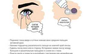 Если не снимается линза – что делать, как вытащить из глаза безопасно и эффективно