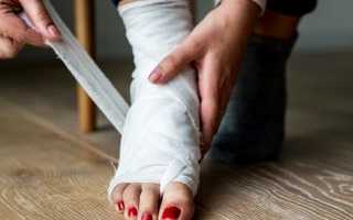 Перелом пяточной кости: неотложная помощь, лечение и восстановление, видео