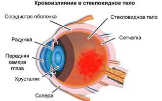От чего лопаются сосуды в глазах и как справиться с данной проблемой эффективно?