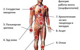 Что такое гепатит B? Заражение, симптомы и способы лечения