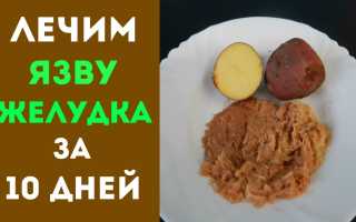 Лечение язвы двенадцатиперстной кишки: народные средства, рецепты и видео