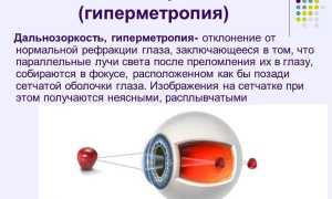 Почему у детей может возникнуть гиперметропия и как с этим справиться