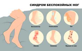Синдром тяжелых ног при беременности: причины и лечение