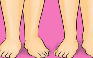 Как снять отечность после застолья? Практические рекомедации