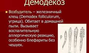 Анализ на демодекоз: важные аспекты и рекомендации