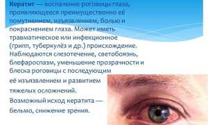 Почему могут гноиться глаза у взрослых и как это лечить правильно?