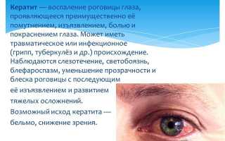Почему могут гноиться глаза у взрослых и как это лечить правильно?