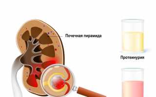 Гломерулонефрит: диагностика, лечение, медицина и народные средства, беременность