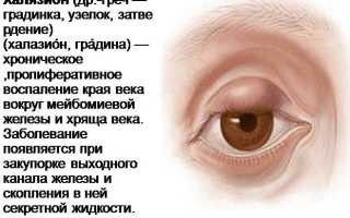 Лечение халязиона у детей – причины, как и чем лечить без операции, советы специалистов