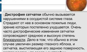 ПХРД глаза: в чём опасность, как лечить? Полезные советы