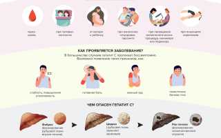 Гепатит С и беременность, возможно ли, особенности и рекомендации
