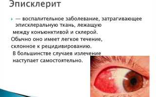 Эписклерит глаза – причины возникновения и методы лечения, советы специалистов