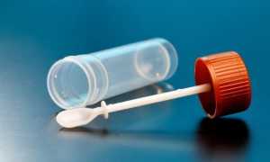 Сколько времени действительны результаты анализов на яйцеглист