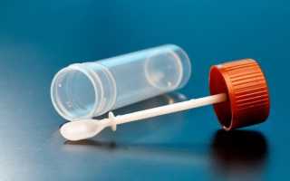 Сколько времени действительны результаты анализов на яйцеглист