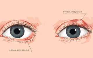 Как лечить ячмень на глазу в домашних условиях: быстрые способы