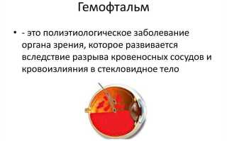 Гемофтальм глаза: что такое и как лечить? Полезные советы и рекомендации