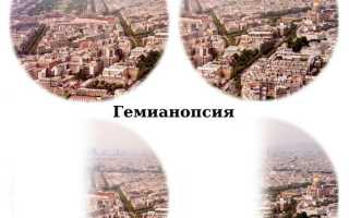 Гемианопсия: природа возникновения и методы устранения заболеваний зрения