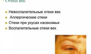 Отёк нижнего века – почему происходит и как бороться с данной проблемой эффективно
