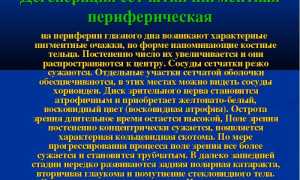 Периферическая дистрофия сетчатки глаза: основные симптомы и методы лечения, рекомендации специалистов