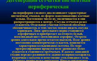 Периферическая дистрофия сетчатки глаза: основные симптомы и методы лечения, рекомендации специалистов