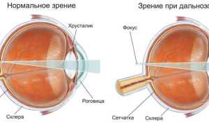 Зрение новорожденных в первые дни – как развивается и что важно знать
