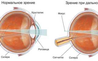 Зрение новорожденных в первые дни – как развивается и что важно знать