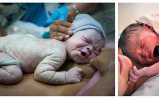 Перенашивание беременности: как родить здорового малыша