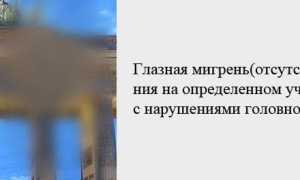 Мерцательная скотома (глазная мигрень): характерные признаки и способы лечения, важные советы