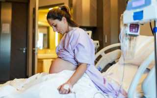 Когда нужно ли ложиться в роддом заранее для подготовки