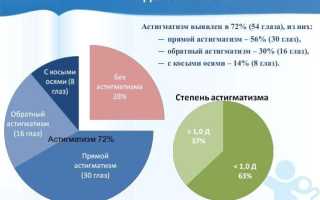 Астигматизм – причины, как проявляется и чем опасен, от чего появляется и возникает, а также его лечение
