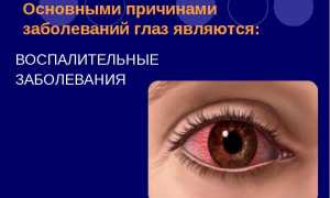 Заболевания век – болячки и воспаления под глазами: как называются и как лечить