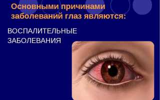 Заболевания век – болячки и воспаления под глазами: как называются и как лечить