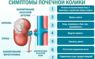 Почечная колика при беременности: причины и лечение