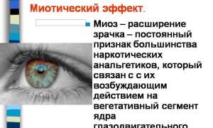 Миоз: вариант нормы или патологический процесс в медицине?