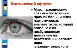 Миоз: вариант нормы или патологический процесс в медицине?