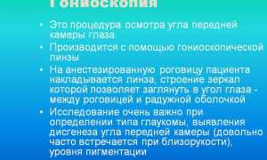 Гониоскопия в офтальмологии: методы и преимущества