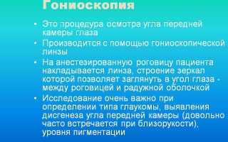 Гониоскопия в офтальмологии: методы и преимущества