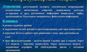 Почему возникает ретробульбарный неврит зрительного нерва и его последствия